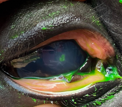 Image of green dye in a horse's eye during an examination for corneal ulcers.